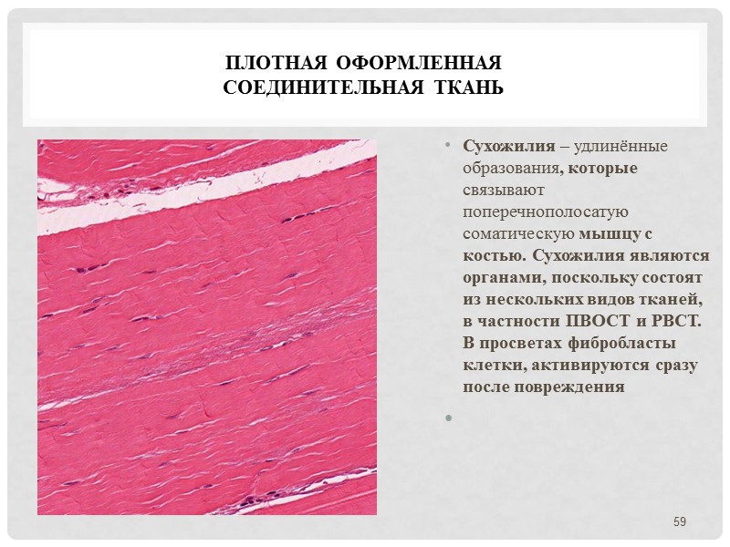 Плотная оформленная  соединительная ткань  Сухожилия – удлинённые образования, которые связывают поперечнополосатую соматическую